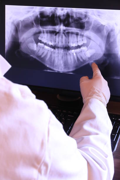 Best Emergency Root Canal Treatment in Lamesa, TX